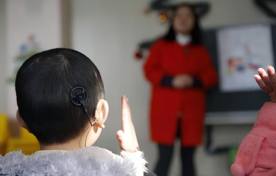 A child with a traditional cochlear implant. [Photo/VCG]