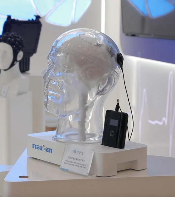 First brain-computer implant in Shanghai opens new medical frontiers2_副本.png